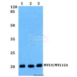 Anti-MYL9/MYL12A (P13) Antibody from Bioworld Technology (BS1552) - Antibodies.com