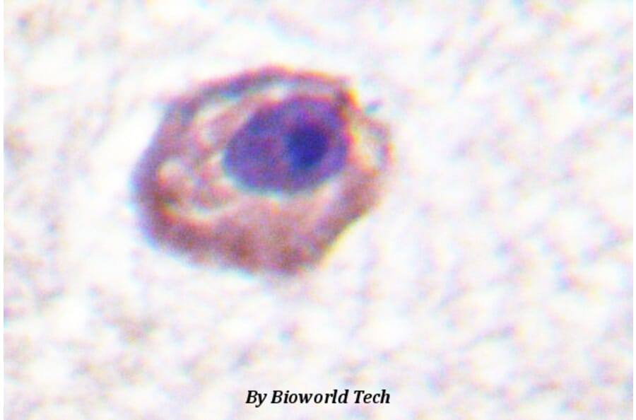 Anti-MYL9/MYL12A (P13) Antibody from Bioworld Technology (BS1552) - Antibodies.com