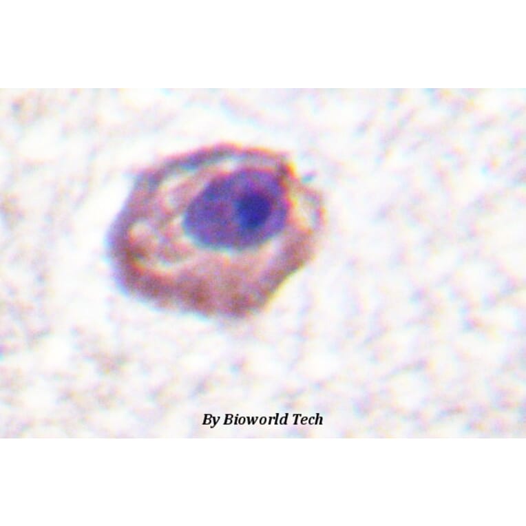 Anti-MYL9/MYL12A (P13) Antibody from Bioworld Technology (BS1552) - Antibodies.com