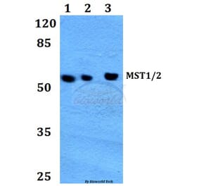 Anti-MST1/2 (M178) Antibody from Bioworld Technology (BS1554) - Antibodies.com