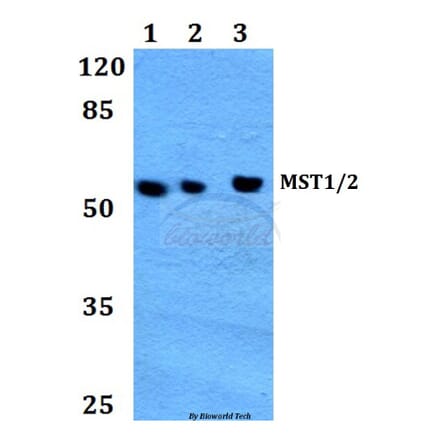 Anti-MST1/2 (M178) Antibody from Bioworld Technology (BS1554) - Antibodies.com