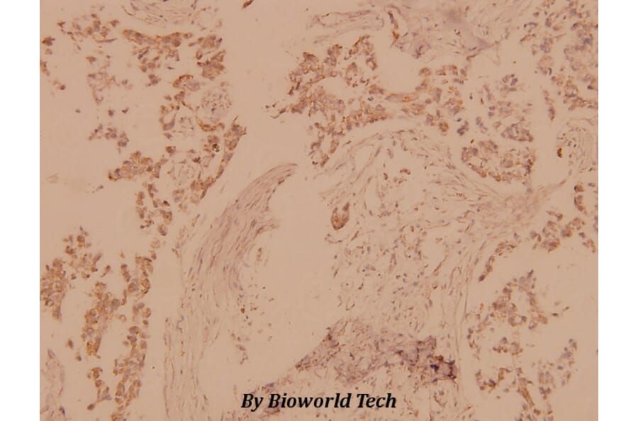 Anti-MST1/2 (M178) Antibody from Bioworld Technology (BS1554) - Antibodies.com