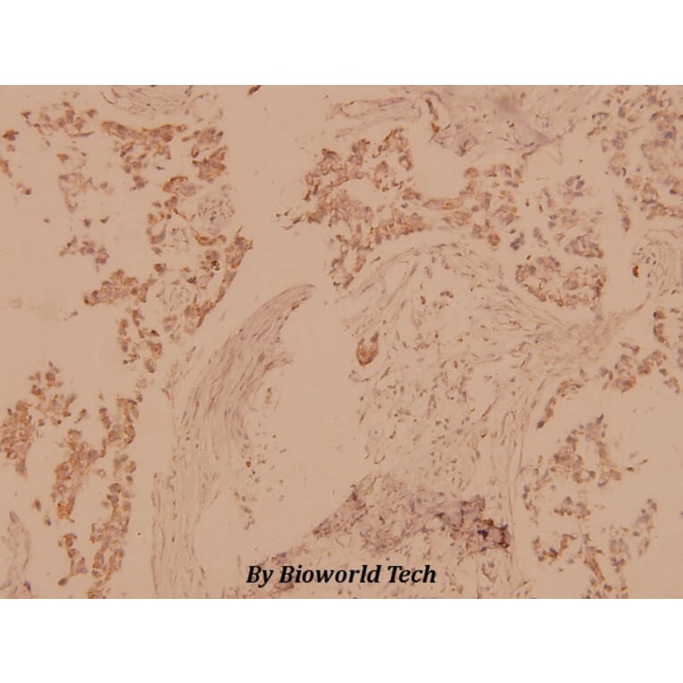 Anti-MST1/2 (M178) Antibody from Bioworld Technology (BS1554) - Antibodies.com