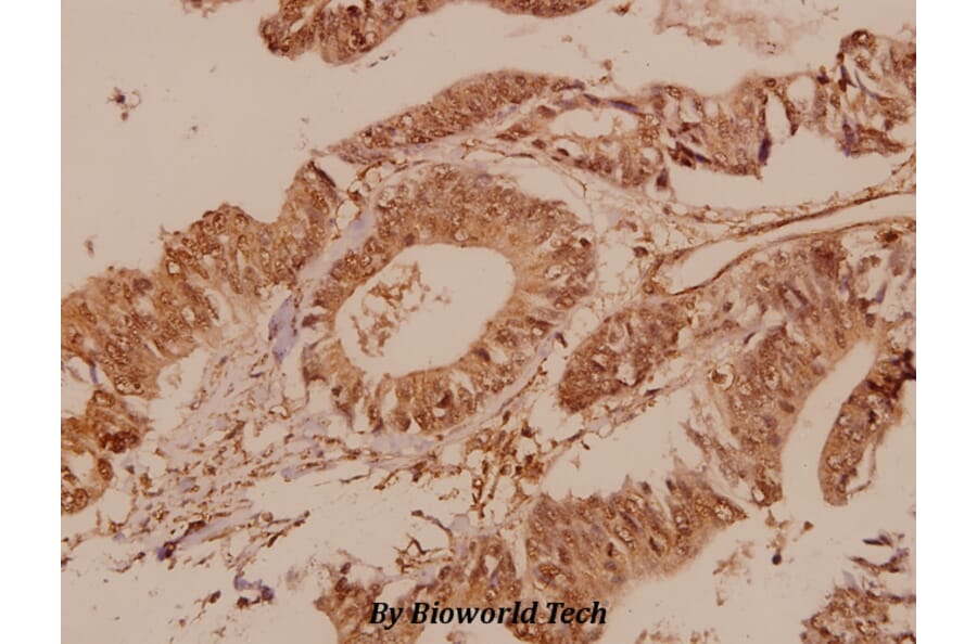 Anti-mTOR (P2476) Antibody from Bioworld Technology (BS1555) - Antibodies.com