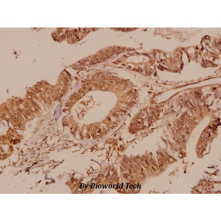 Anti-mTOR (P2476) Antibody from Bioworld Technology (BS1555) - Antibodies.com