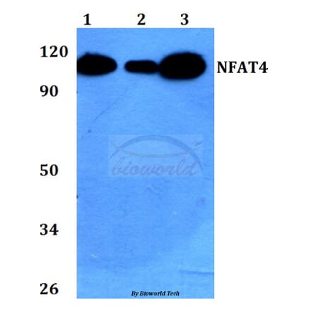 Anti-NFAT4 (E159) Antibody from Bioworld Technology (BS1559) - Antibodies.com