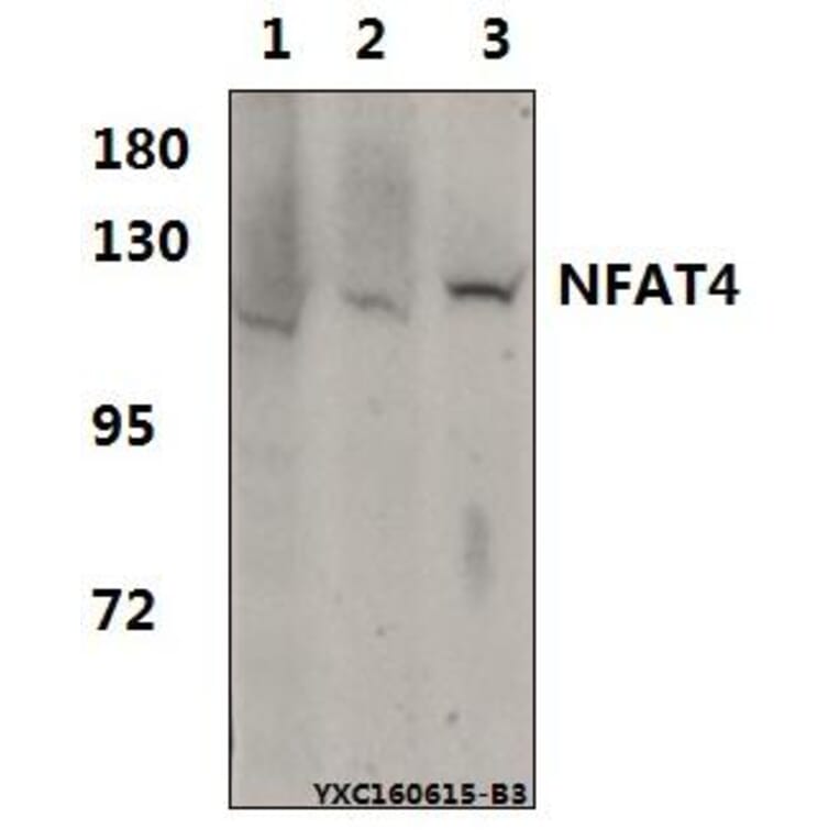 Anti-NFAT4 (E159) Antibody from Bioworld Technology (BS1559) - Antibodies.com