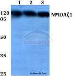 Anti-NMDAζ1 (S885) Antibody from Bioworld Technology (BS1561) - Antibodies.com