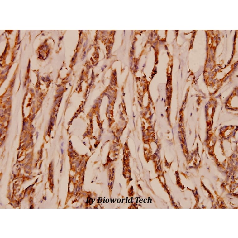 Anti-NMDAζ1 (S885) Antibody from Bioworld Technology (BS1561) - Antibodies.com