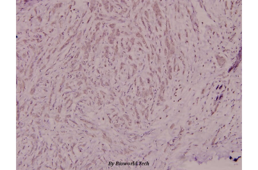 Anti-p40-phox (R149) Antibody from Bioworld Technology (BS1563) - Antibodies.com