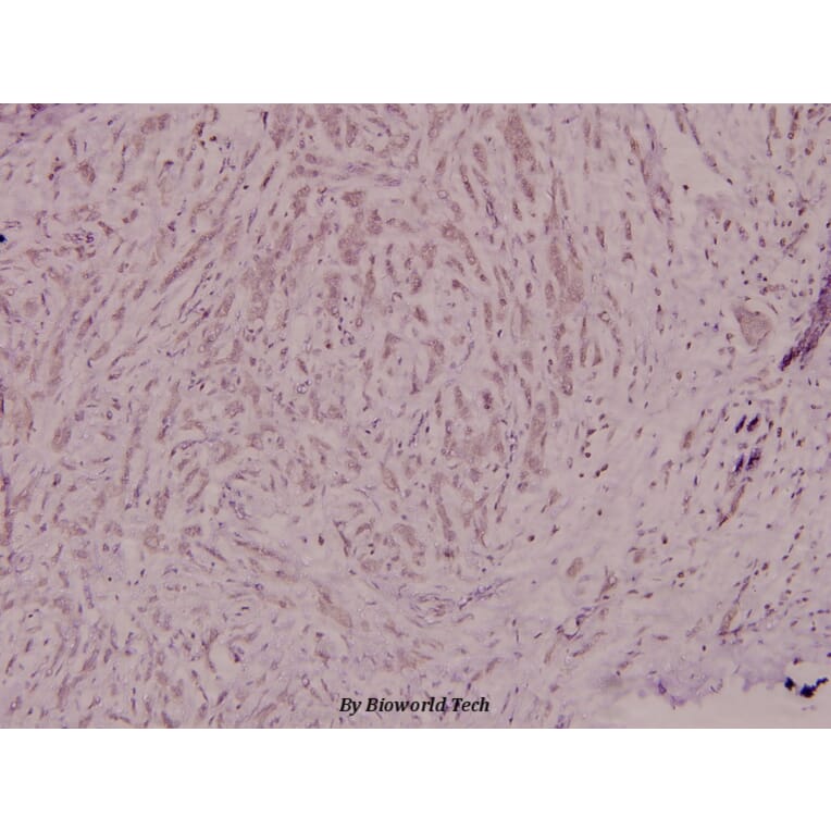 Anti-p40-phox (R149) Antibody from Bioworld Technology (BS1563) - Antibodies.com