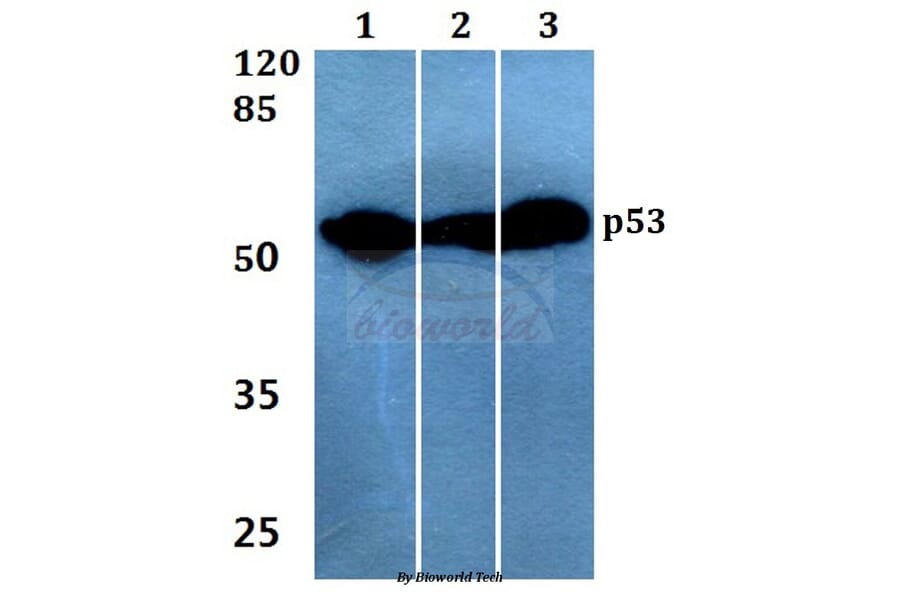 Anti-p53 (K386) Antibody from Bioworld Technology (BS1564) - Antibodies.com