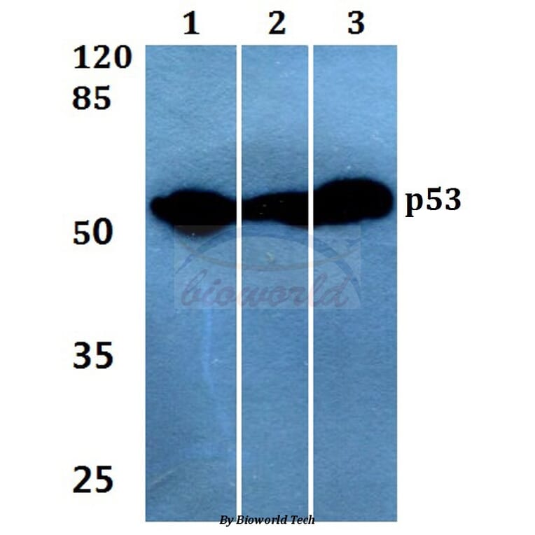 Anti-p53 (K386) Antibody from Bioworld Technology (BS1564) - Antibodies.com