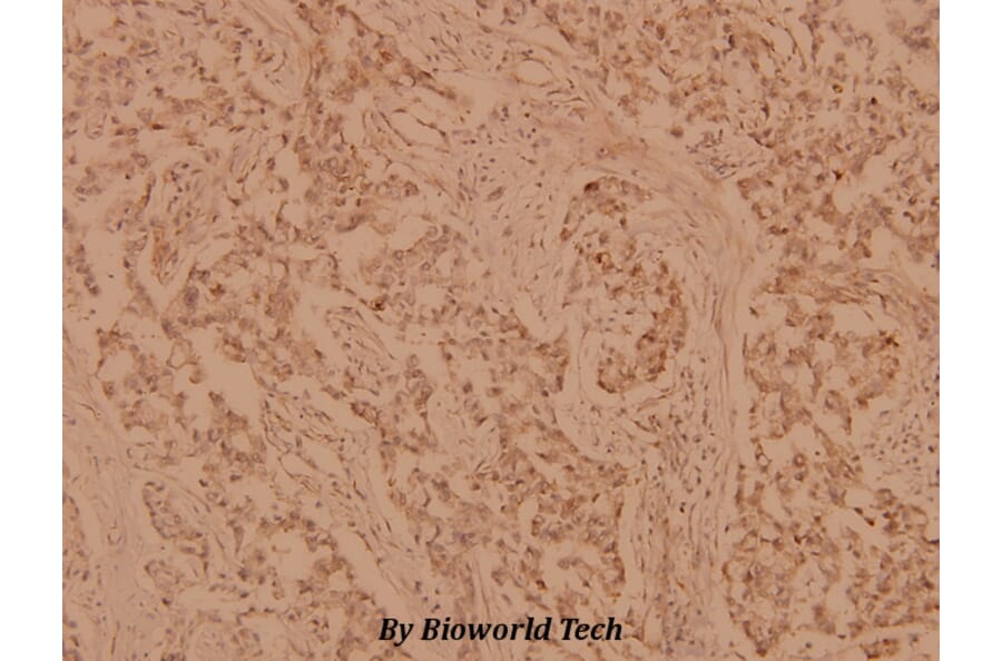 Anti-p70 S6K (P412) Antibody from Bioworld Technology (BS1567) - Antibodies.com