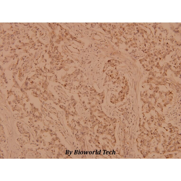 Anti-p70 S6K (P412) Antibody from Bioworld Technology (BS1567) - Antibodies.com