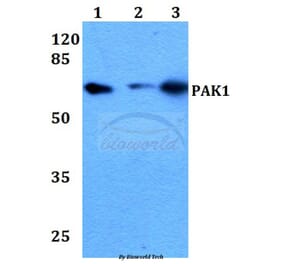 Anti-PAK1 (I206) Antibody from Bioworld Technology (BS1569) - Antibodies.com