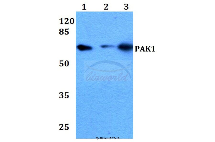 Anti-PAK1 (I206) Antibody from Bioworld Technology (BS1569) - Antibodies.com