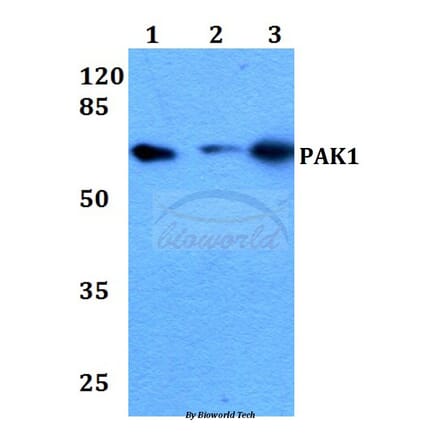 Anti-PAK1 (I206) Antibody from Bioworld Technology (BS1569) - Antibodies.com