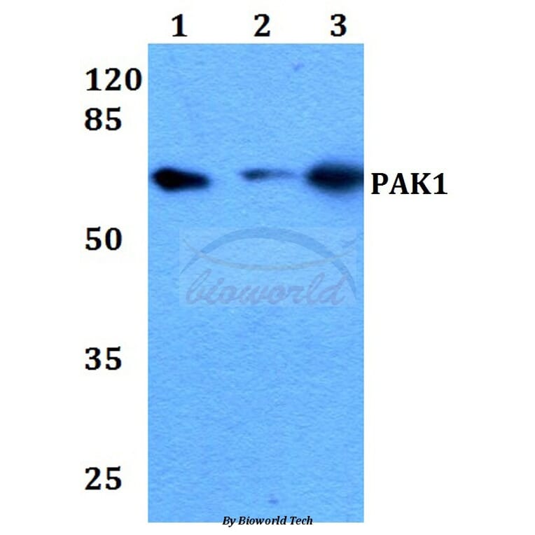 Anti-PAK1 (I206) Antibody from Bioworld Technology (BS1569) - Antibodies.com