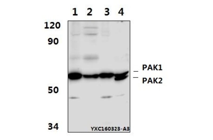 Anti-PAK1 (I206) Antibody from Bioworld Technology (BS1569) - Antibodies.com