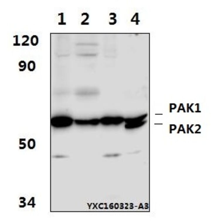 Anti-PAK1 (I206) Antibody from Bioworld Technology (BS1569) - Antibodies.com