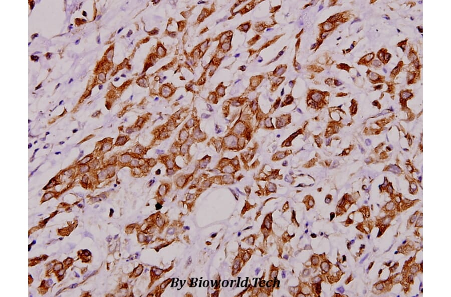 Anti-PAK1 (I206) Antibody from Bioworld Technology (BS1569) - Antibodies.com