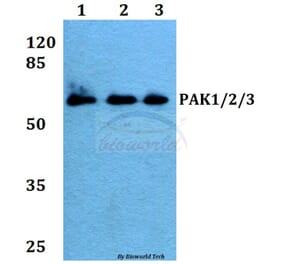 Anti-PAK1/2/3 (E417) Antibody from Bioworld Technology (BS1570) - Antibodies.com