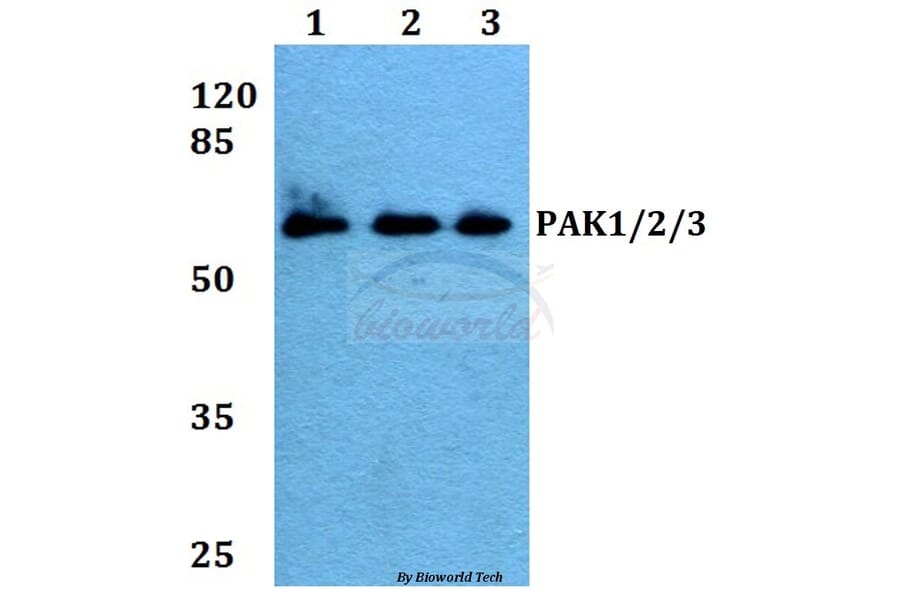 Anti-PAK1/2/3 (E417) Antibody from Bioworld Technology (BS1570) - Antibodies.com
