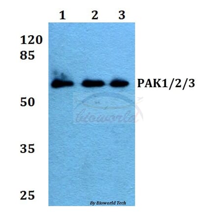 Anti-PAK1/2/3 (E417) Antibody from Bioworld Technology (BS1570) - Antibodies.com