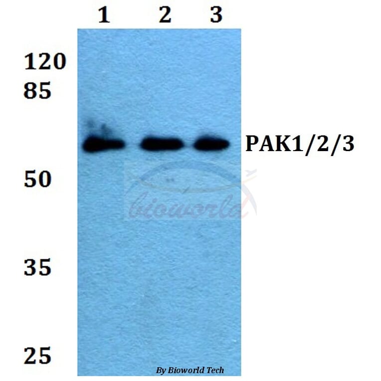 Anti-PAK1/2/3 (E417) Antibody from Bioworld Technology (BS1570) - Antibodies.com
