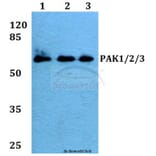 Anti-PAK1/2/3 (E417) Antibody from Bioworld Technology (BS1570) - Antibodies.com