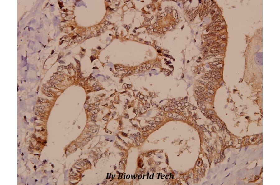 Anti-PAK1/2/3 (E417) Antibody from Bioworld Technology (BS1570) - Antibodies.com