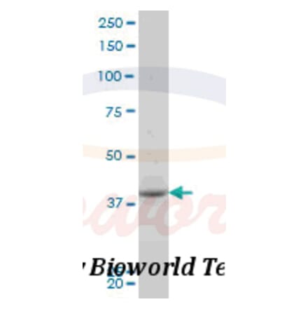 Anti-PBK (I4) Antibody from Bioworld Technology (BS1571) - Antibodies.com