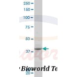 Anti-PBK (I4) Antibody from Bioworld Technology (BS1571) - Antibodies.com