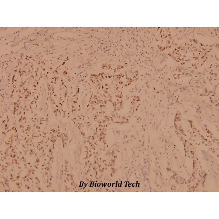Anti-PBK (I4) Antibody from Bioworld Technology (BS1571) - Antibodies.com