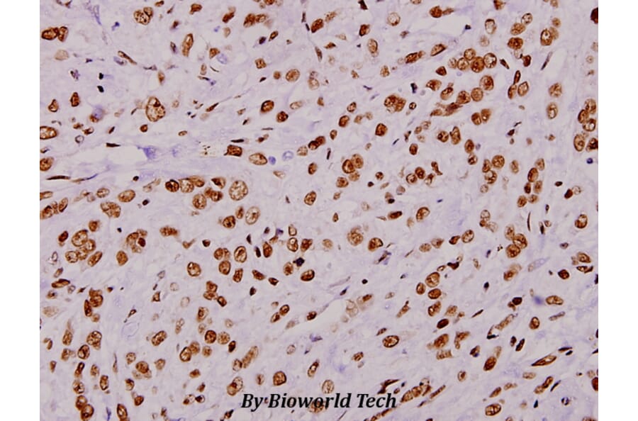 Anti-PDE4D (H47) Antibody from Bioworld Technology (BS1572) - Antibodies.com