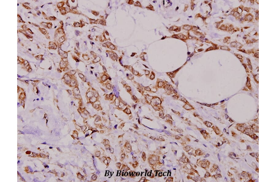 Anti-PEA-15 (D110) Antibody from Bioworld Technology (BS1573) - Antibodies.com
