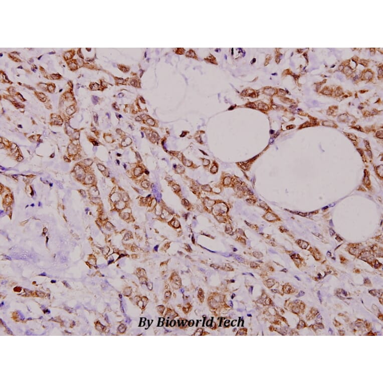 Anti-PEA-15 (D110) Antibody from Bioworld Technology (BS1573) - Antibodies.com