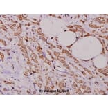 Anti-PEA-15 (D110) Antibody from Bioworld Technology (BS1573) - Antibodies.com