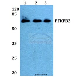 Anti-PFKFB2 (P479) Antibody from Bioworld Technology (BS1575) - Antibodies.com