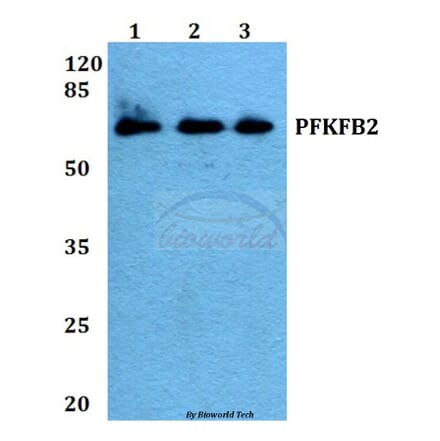 Anti-PFKFB2 (P479) Antibody from Bioworld Technology (BS1575) - Antibodies.com