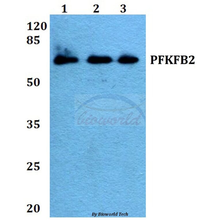 Anti-PFKFB2 (P479) Antibody from Bioworld Technology (BS1575) - Antibodies.com