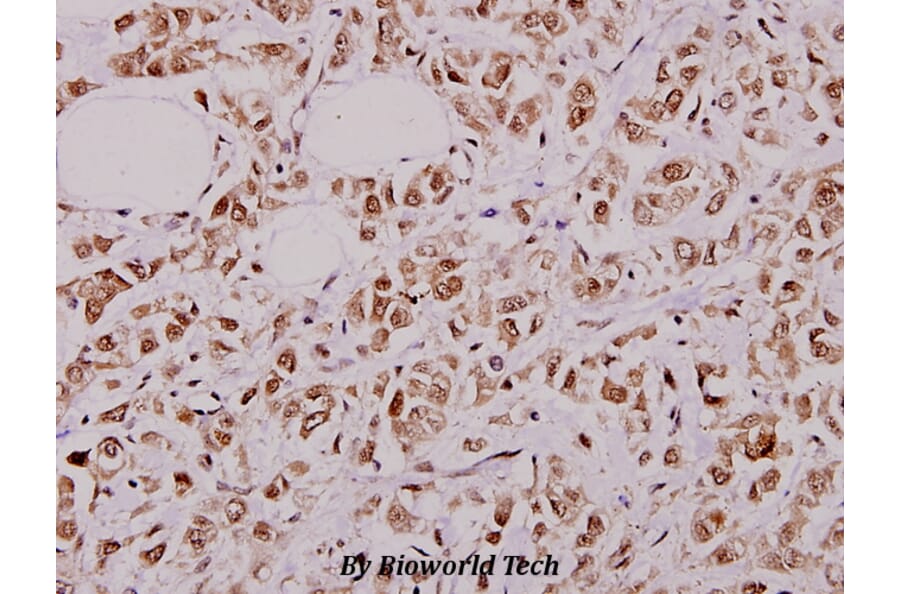 Anti-PFKFB2 (P479) Antibody from Bioworld Technology (BS1575) - Antibodies.com