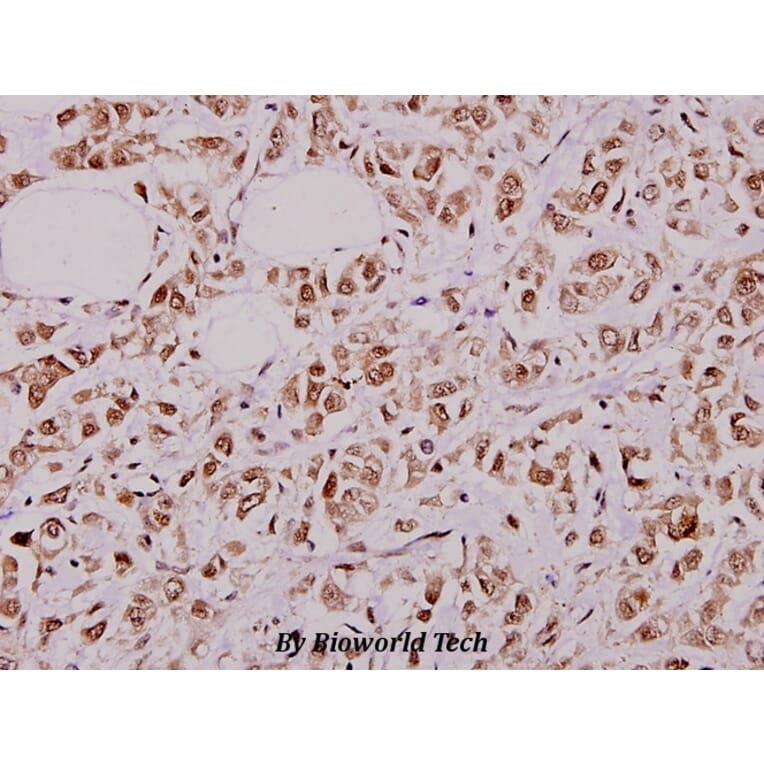 Anti-PFKFB2 (P479) Antibody from Bioworld Technology (BS1575) - Antibodies.com