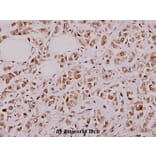 Anti-PFKFB2 (P479) Antibody from Bioworld Technology (BS1575) - Antibodies.com