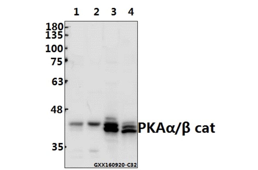 Anti-PKAα/β cat (V191) Antibody from Bioworld Technology (BS1576) - Antibodies.com