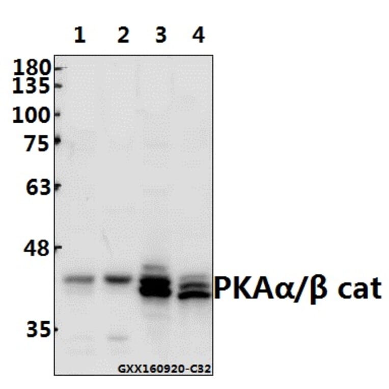 Anti-PKAα/β cat (V191) Antibody from Bioworld Technology (BS1576) - Antibodies.com