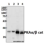 Anti-PKAα/β cat (V191) Antibody from Bioworld Technology (BS1576) - Antibodies.com