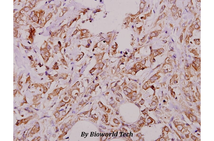 Anti-PKAα/β cat (V191) Antibody from Bioworld Technology (BS1576) - Antibodies.com