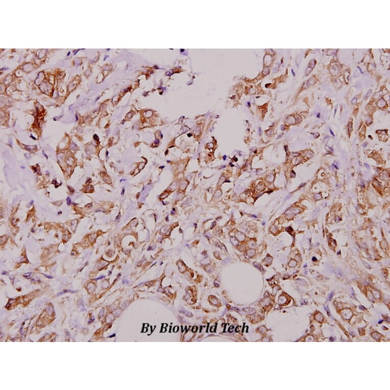 Anti-PKAα/β cat (V191) Antibody from Bioworld Technology (BS1576) - Antibodies.com
